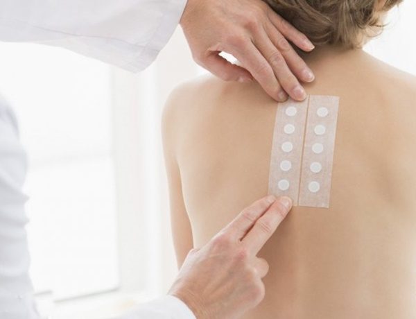Dermatiti e allergie da contatto: la verifica con i patch test cutanei